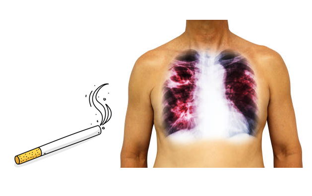 Giải độc phổi cho người hút thuốc lá bằng cách nào?