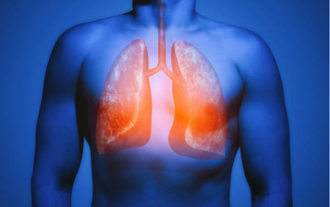 Nhiễm độc phổi là gì, làm sao để giải độc phổi hiệu quả?